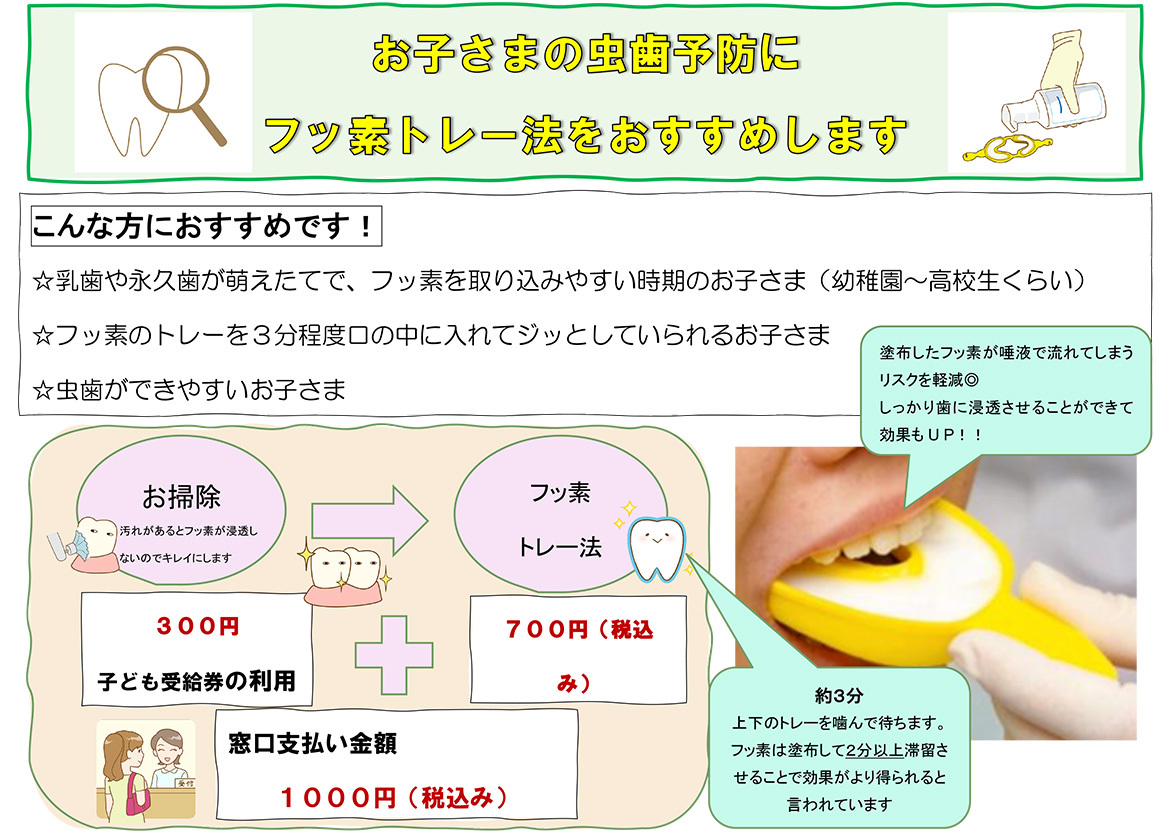 フッ素塗布