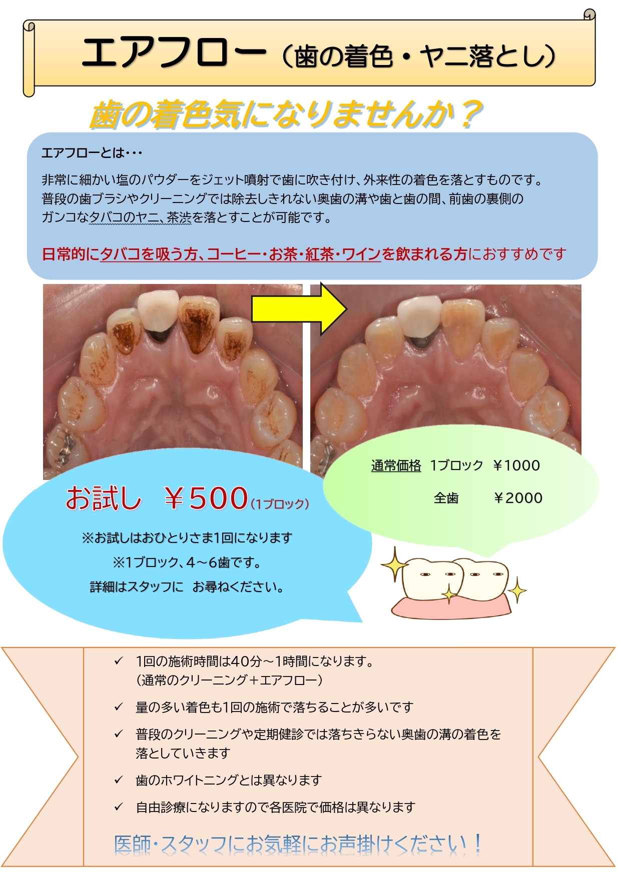 エアフロークリーニング